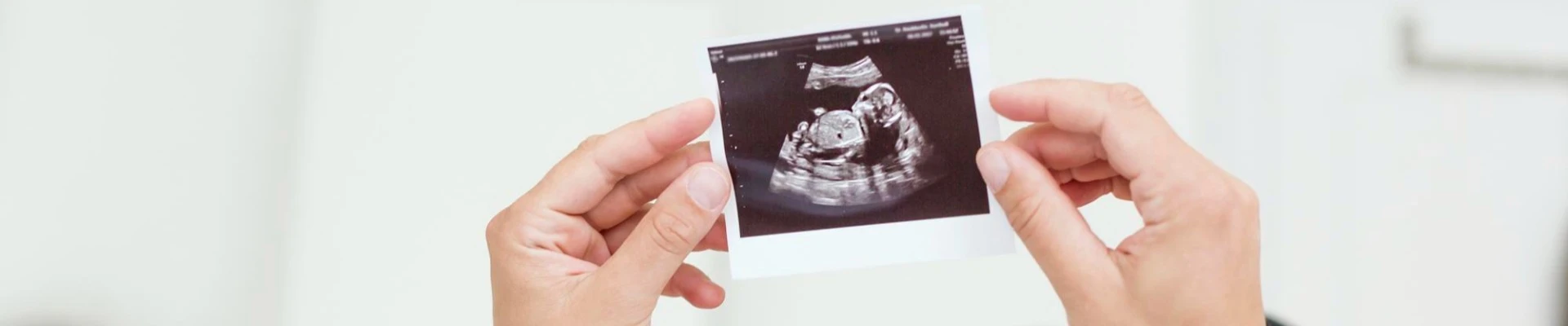 Fetal Echocardiography and Interventional Treatment